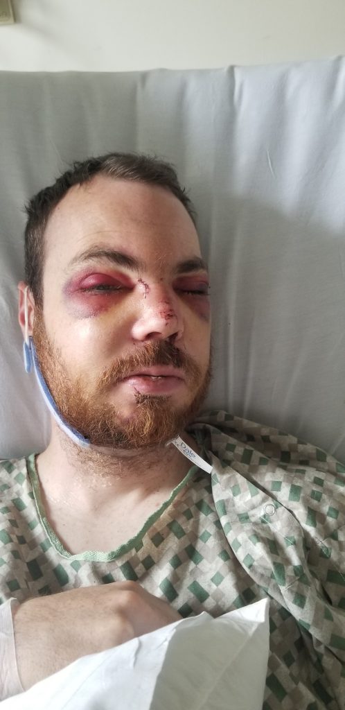 David in hospital